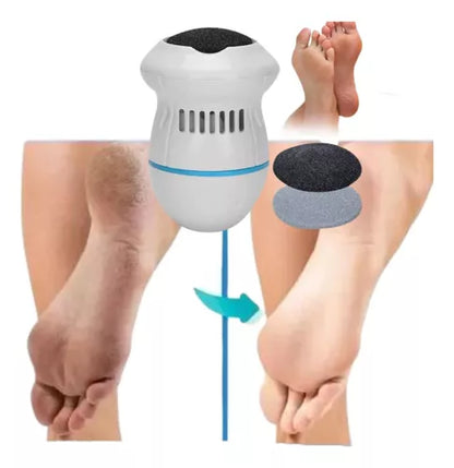 Soft Feet® | Pies suaves en minutos