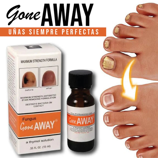 GONE AWAY ™|UÑAS SANAS